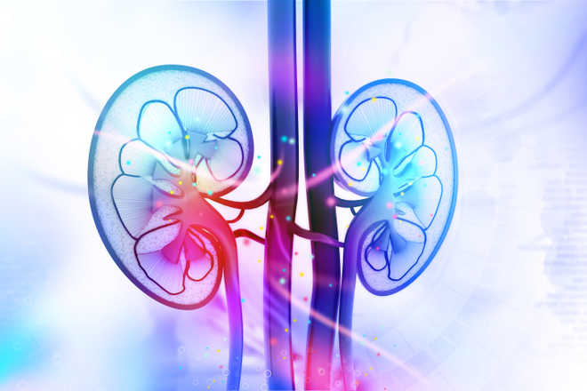 New algorithm predicts likelihood of acute kidney injury