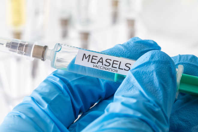 Major measles outbreaks forecast for 2021 due to Covid: Study