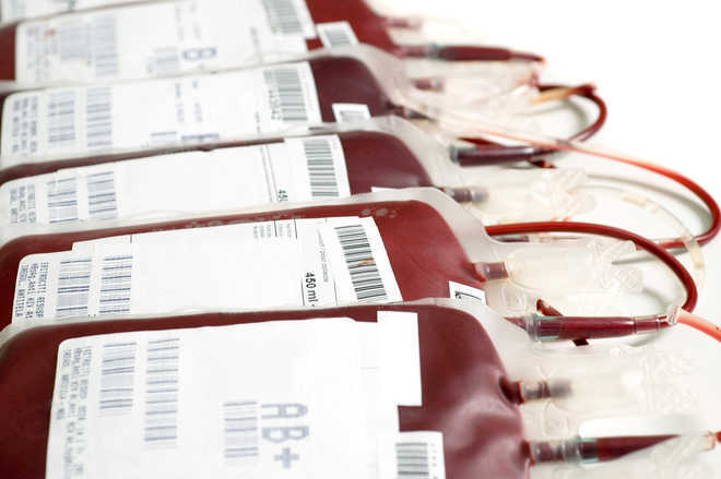 4 dismissed over HIV blood transfusion