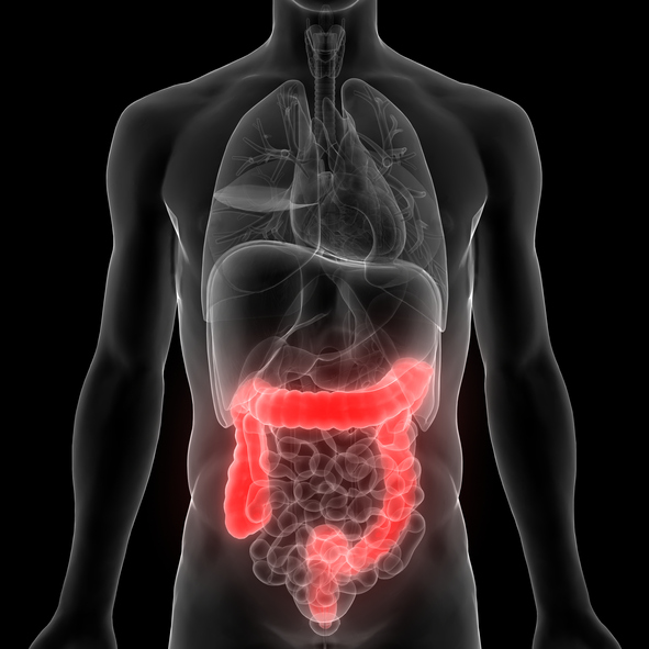 People with inflammatory bowel disease likely to die early