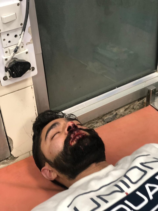 ABVP member injured in attack at PU