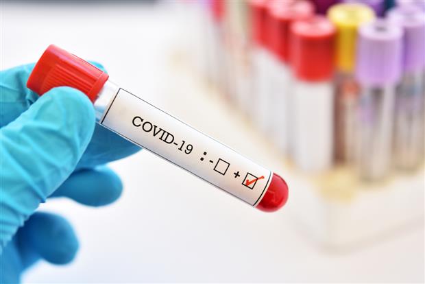 Mohali reports four new coronavirus case