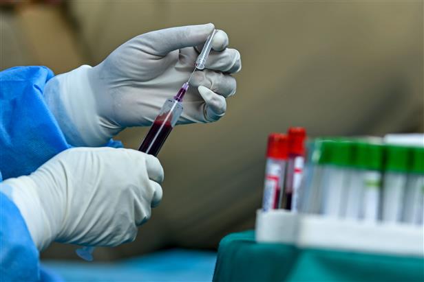 Rapid antigen tests strengthen fight against COVID-19, say experts