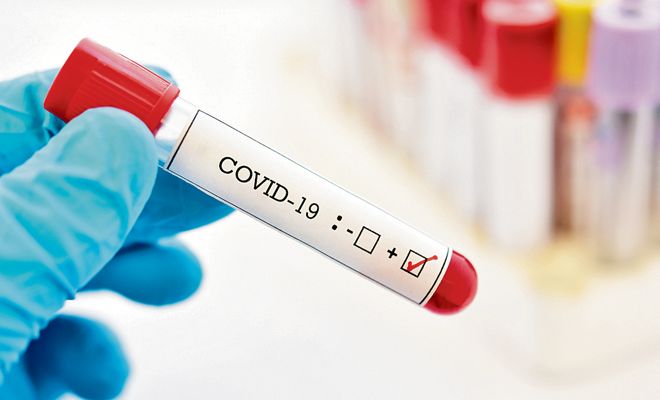 35,695 Covid-19 tests conducted at four Chandigarh labs