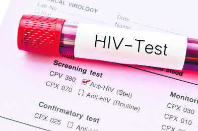 Scientists develop injectable HIV drug with fewer side effects