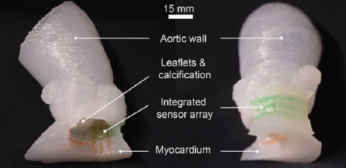 In a first, researchers 3D print lifelike heart valve models