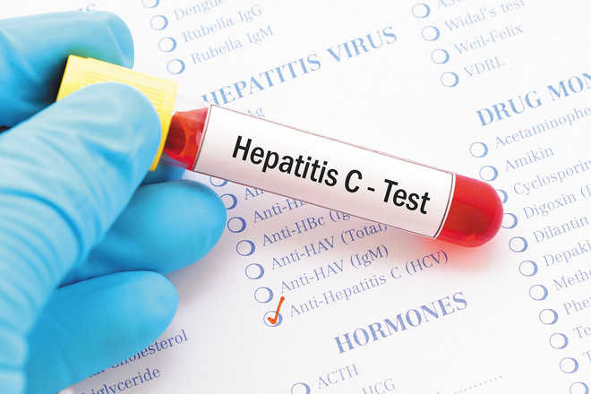 Anti-hepatitis C drug test on patients soon
