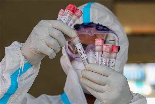Chandigarh adds 305 more coronavirus cases; tally stands past 7,000