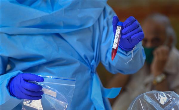 347 new coronavirus cases push Chandigarh tally past 8,500
