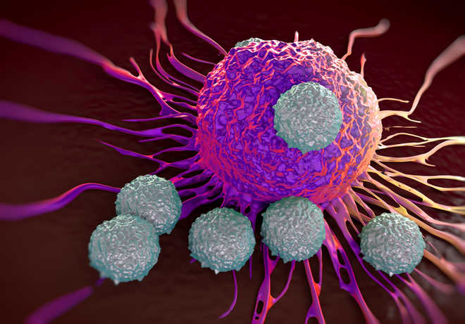 New drug combination may help treat acute myeloid leukemia