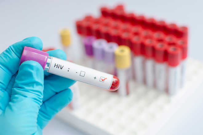 Scientists identify second HIV patient whose body likely rid itself of virus