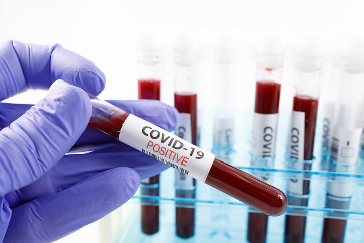 UK-returned woman in Hyderabad tests Covid positive