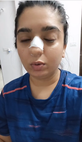 Bengaluru woman claims Zomato delivery man punched her, shows bloody nose; executive arrested