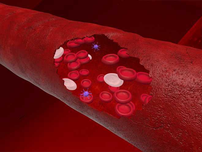 Why are some Covid-19 survivors at risk of blood clot