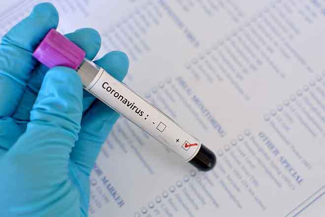 Chandigarh sees 397 Covid cases
