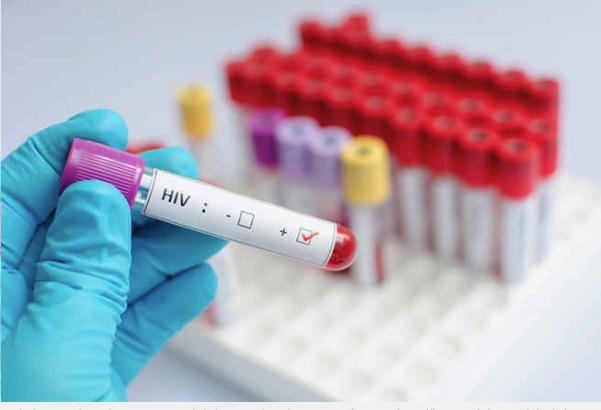 HIV/AIDS vaccine: Why don't we have one after 37 years, when we have several for COVID-19 after a few months?