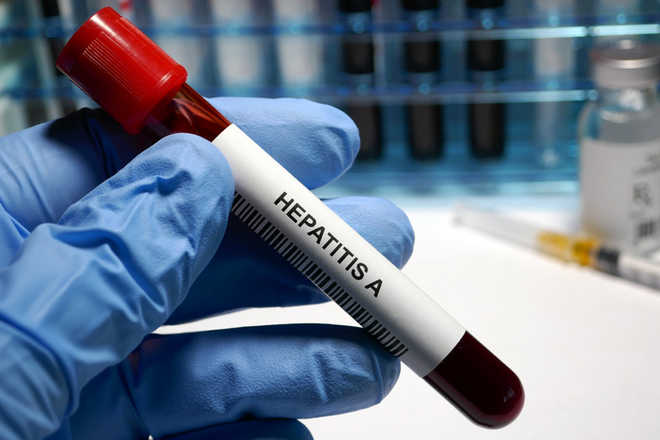 Punjab introduces free testing, treatment of Hepatitis B in all govt health institutions