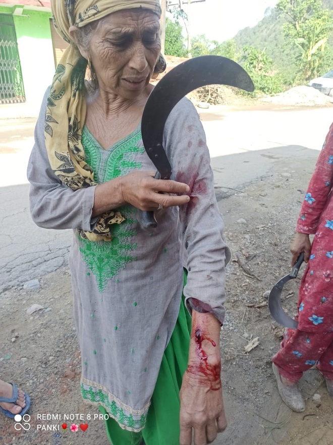 Mandi woman injured in leopard attack
