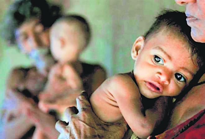 Survey finds 2,500 kids malnourished in Gurugram