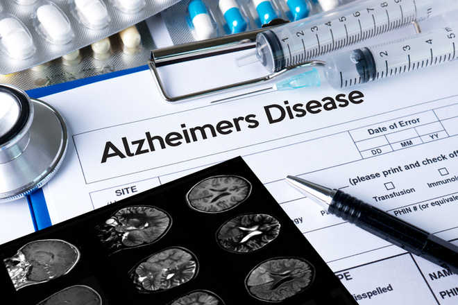 What types of memories are forgotten in Alzheimer's disease?