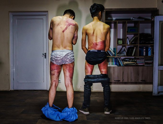Pictures: 2 Afghan journalists detained, beaten brutally by Taliban for covering women's protests