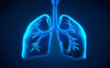 Lung abnormalities found in long Covid patients with breathlessness