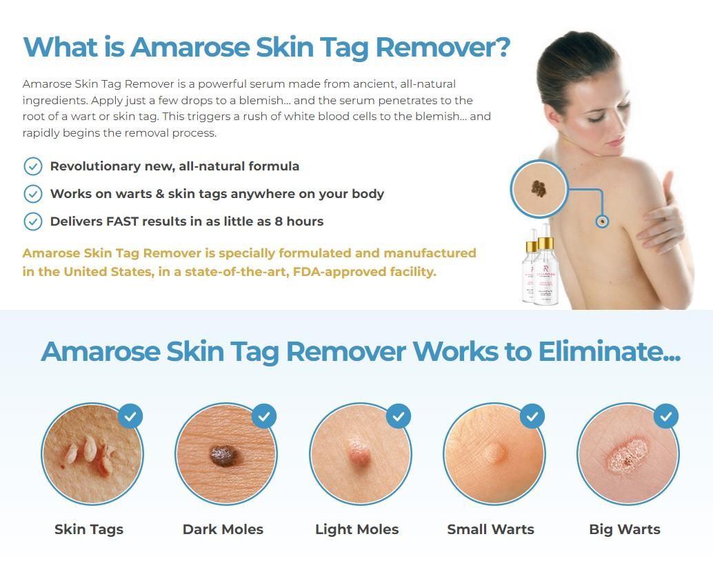 Amarose Skin Tag Remover Reviews SCAM REVEALED Read Before Buying