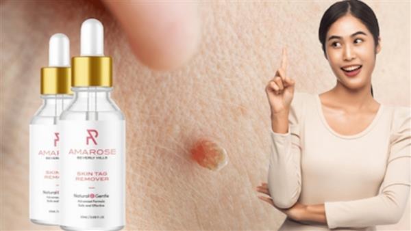 Amarose Skin Tag Remover Reviews (Is It Legit?) Price, Ingredients, Side Effects and Where to Buy?