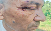 Whistleblower hurt in attack by mining mafia at Rakkar