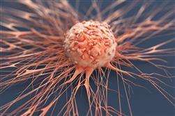 Researchers find immunotherapies for chemotherapy-resistant breast tumour