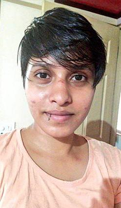 Shraddha Walker’s photo with bruises on face surfaces; she used to complain to her friends about Aaftab’s drug addiction and how he would beat her up : The Tribune India