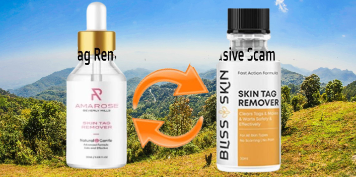 'Bliss Skin Tag Remover' Reviews: (New Report 2023) Beware!! Does "Bliss Skin" Worth $39.80 Cost?