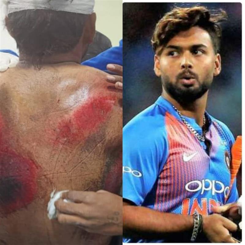 Video: Rishabh Pant dozed off while driving, was alone in car, broke  windscreen to escape as