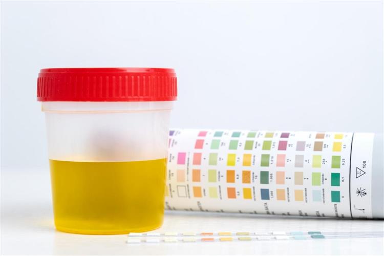 Best Synthetic Urine Kits To Buy 2023: Top 5 Fake Urine Brands To Pass Drug Test