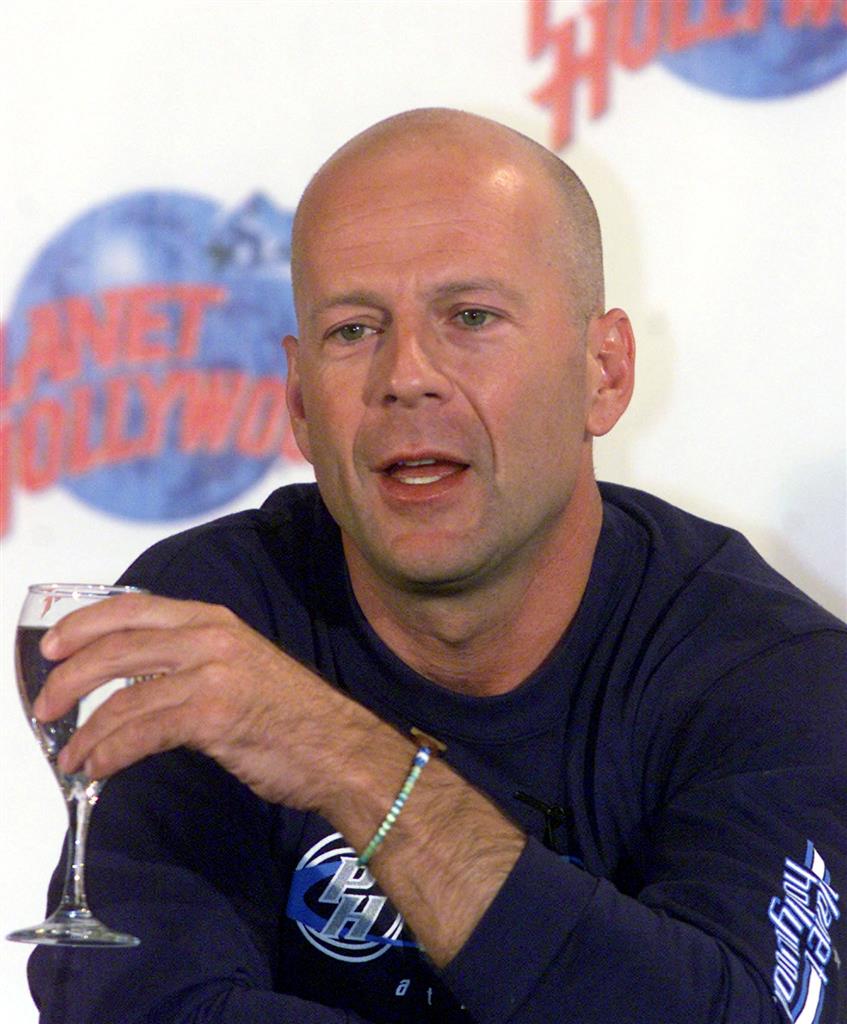What is aphasia that hit ‘Die Hard’ actor Bruce Willis