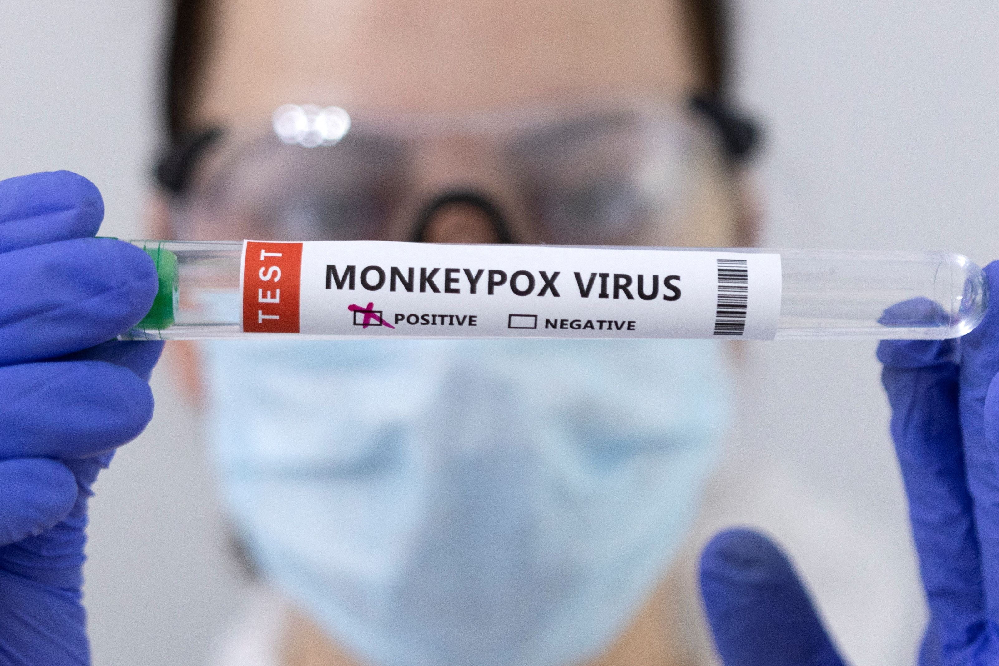 Antiviral drugs may reduce monkeypox symptoms, shorten contagious phase: Lancet study