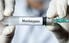 WHO: Nearly 200 cases of monkeypox in more than 20 countries
