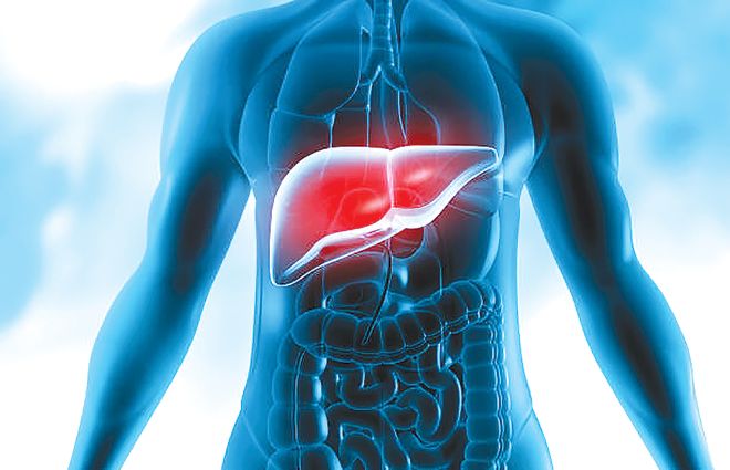 Fatty liver cases rising due to sedentary lifestyle: Doctor