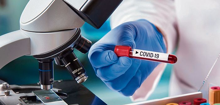 In case of symptoms, get tested for Covid: Mohali Civil Surgeon