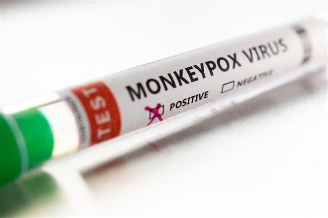 No suspected monkeypox case in Amritsar district: Health officials