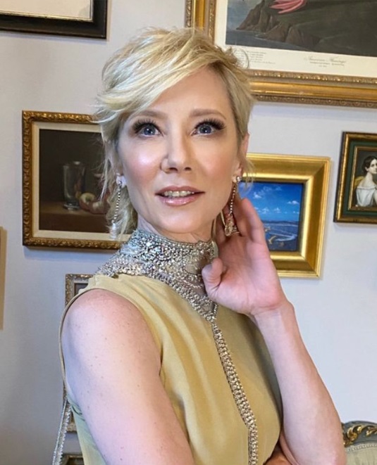 Anne Heche in 'stable condition' after sustaining severe burn injuries in car crash