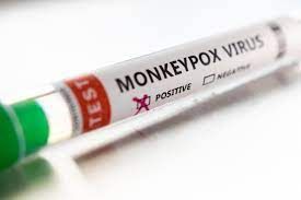 2 suspected cases of monkeypox in Yamunanagar