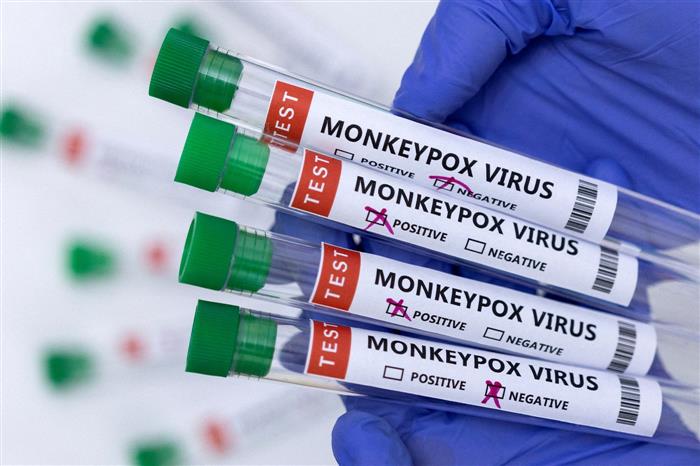 ICMR planning sero-survey among contacts of monkeypox patients