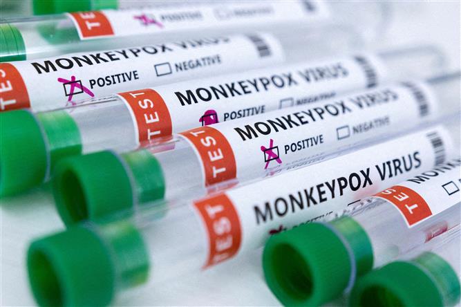 India reports first monkeypox death; 22-year-old Kerala man had tested positive in UAE