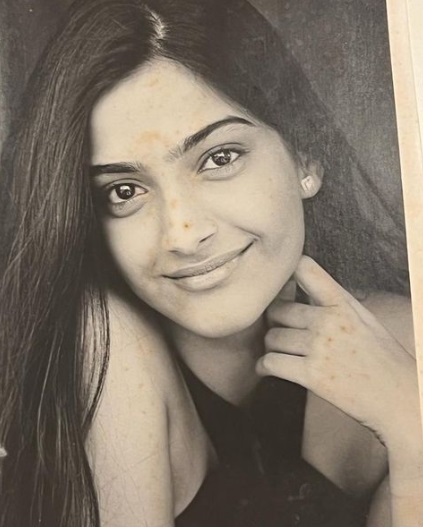 Sonam Kapoor shares a picture from her teen days, Anand Ahuja says, 'you look the same'