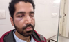 Patiala: Resident doctor attacked at Government Rajindra hospital, suffers multiple facial fractures