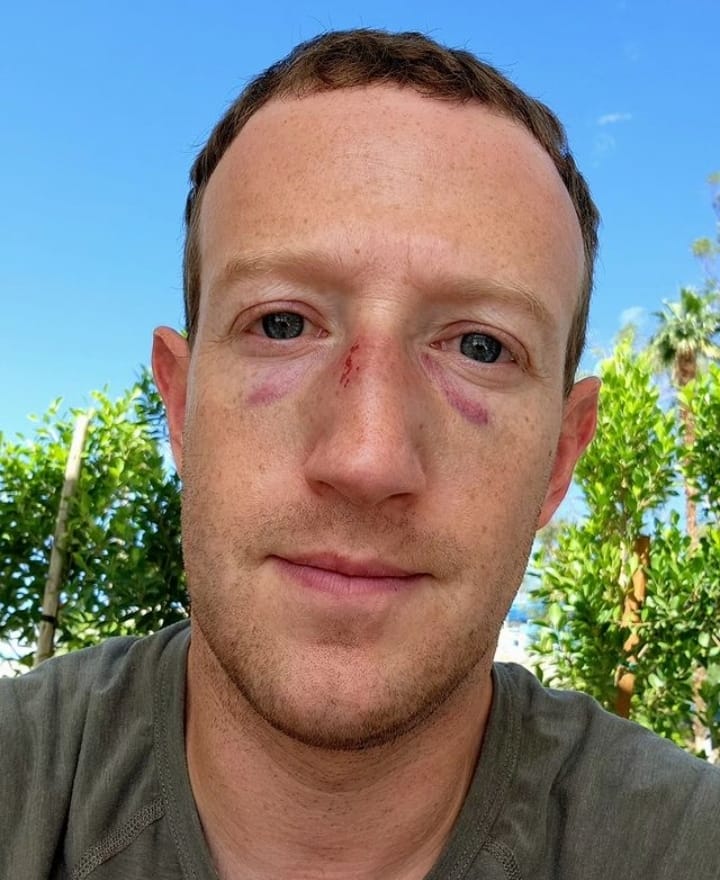 Zuckerberg shares selfie with swelling, bruises on his face; explains what happened