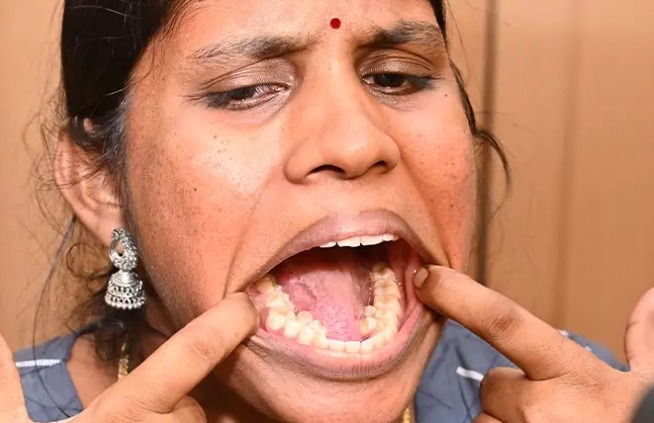 Indian woman Kalpana Balan sets Guinness World Record for most number of teeth