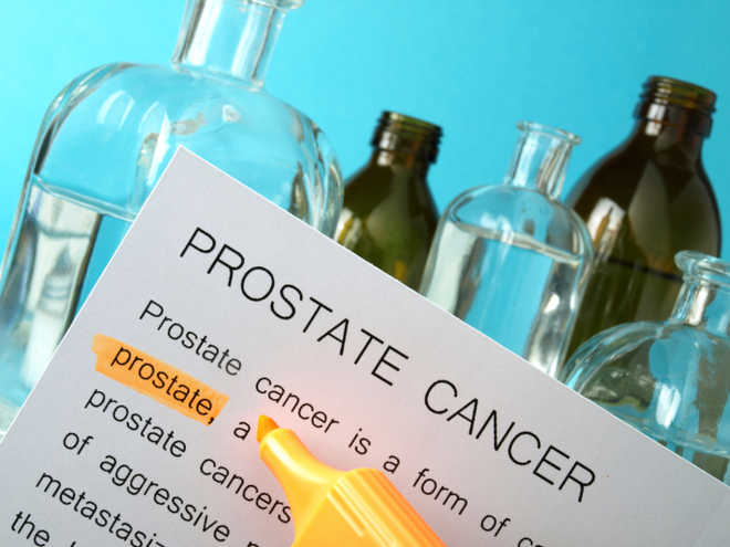 Prostate cancer treatment can wait for most men, finds study