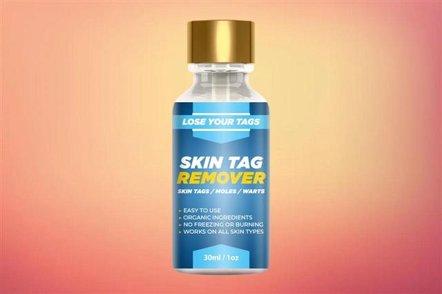 Lose Your Tags Skin Tag Remover Reviews - Cheap Brand or Worthy Brand?